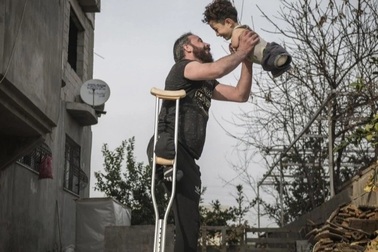 Cậu bé mất hết chân tay đổi đời ngoạn mục chỉ nhờ một bức ảnh gây sốt