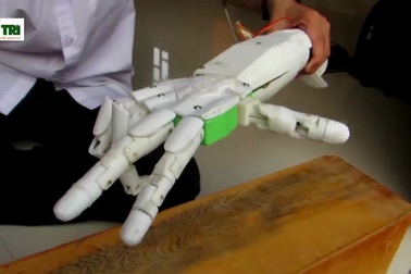 “Cánh tay robot cho người khuyết tật”: Sản phẩm mang tính nhân văn!