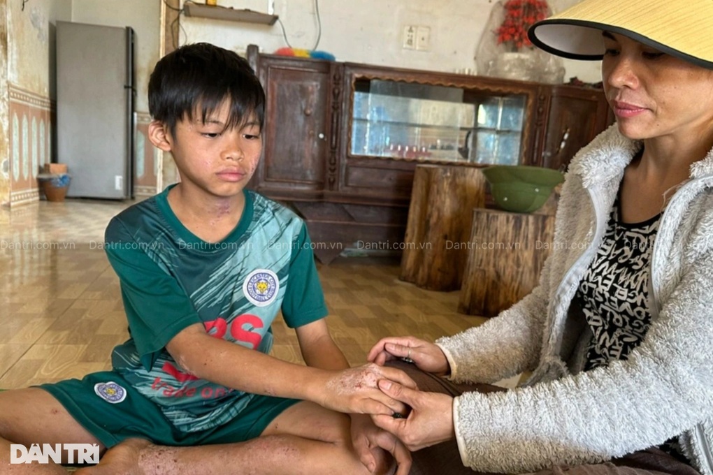 Giá như mẹ có thể chịu thay con những nỗi đau này! - 4 Giá như mẹ có thể chịu thay con những nỗi đau này! - 4