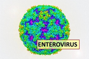 Dấu hiệu cảnh báo viêm màng não virus dễ mắc khi giao mùa