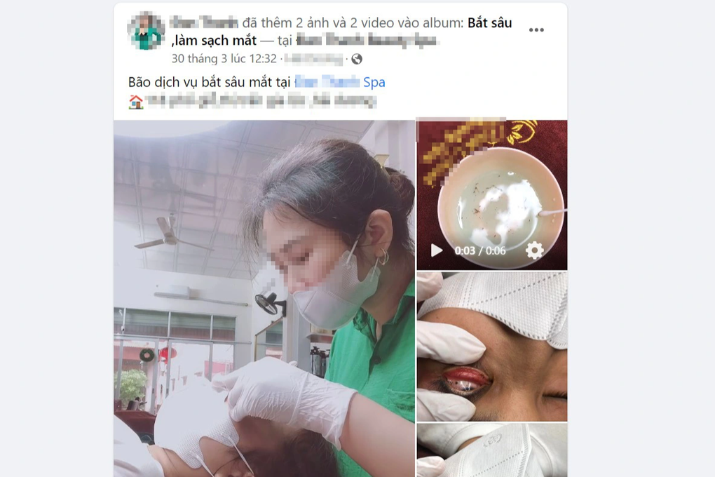 Rước họa vì bắt sâu mắt tại spa - 2 Rước họa vì bắt sâu mắt tại spa - 2