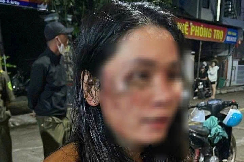 Công an vào cuộc vụ nữ nhân viên giao hàng tố bị khách đánh nhập viện - 1 Công an vào cuộc vụ nữ nhân viên giao hàng tố bị khách đánh nhập viện - 1