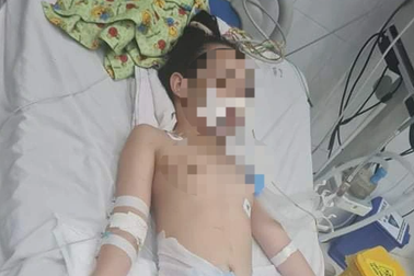 Bé gái 10 tuổi hôn mê gần 2 tháng sau mổ ruột thừa đã tử vong