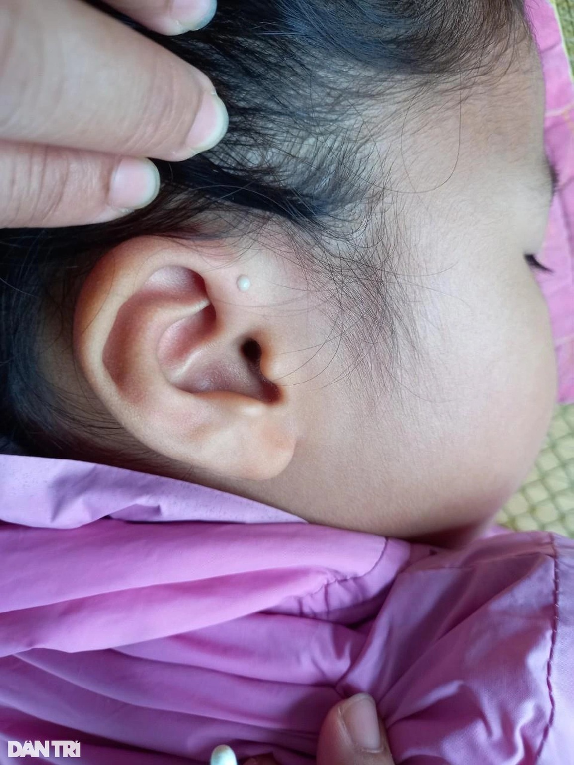 Rơi nước mắt cảnh cha bỏ điều trị, nhường sự sống cho con gái hở van tim - 3 Rơi nước mắt cảnh cha bỏ điều trị, nhường sự sống cho con gái hở van tim - 3