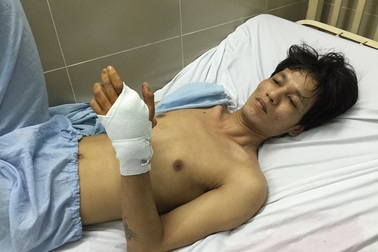 Nổ súng trong tiệm game bắn cá, 1 người bị thương