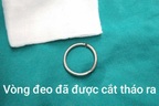 Hà Nội: Nam thanh niên bị vòng kim loại siết chặt vùng bìu suốt 10 ngày