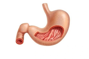 Nguy cơ ung thư từ viêm teo niêm mạc dạ dày