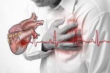 Liên tục có ca nhồi máu cơ tim nguy kịch: Coi chừng nhầm với đau dạ dày