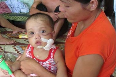 Sức khỏe hai chị em bị bò húc tiến triển tốt