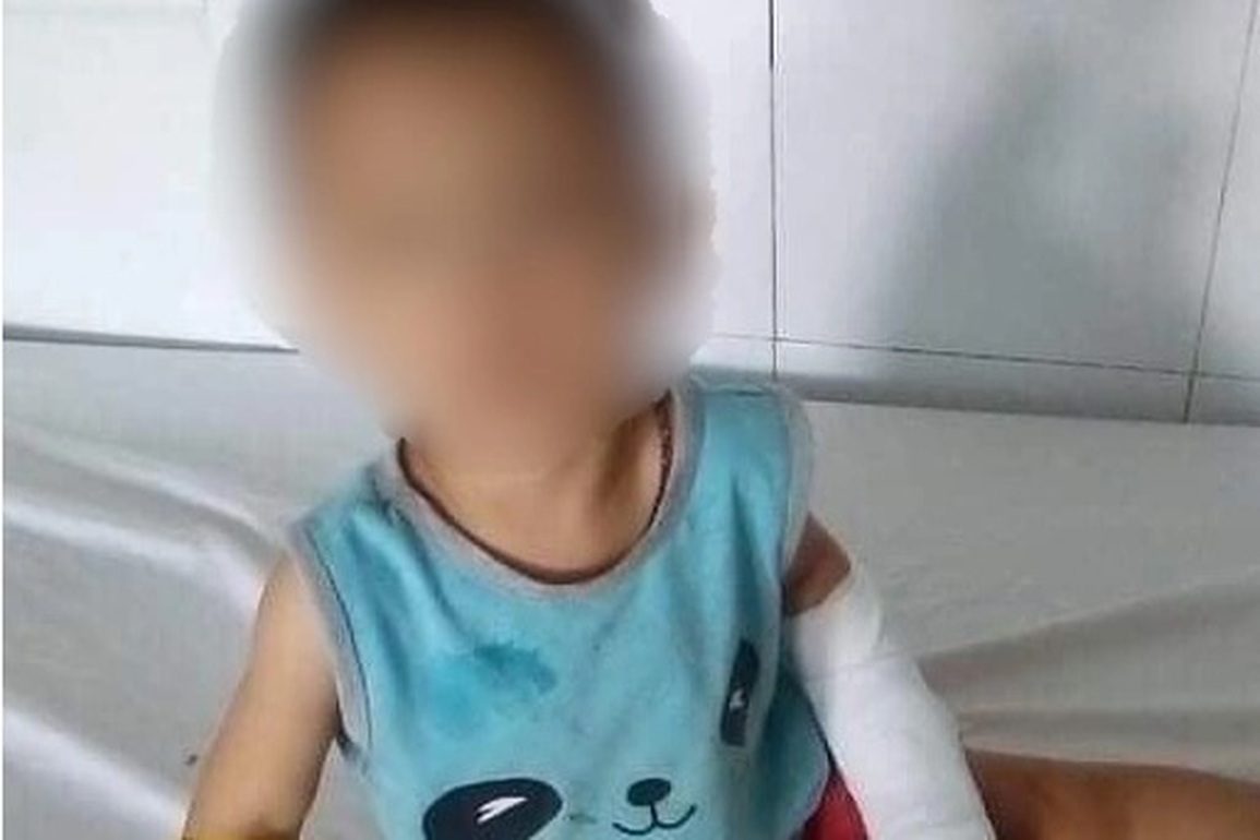 Bị gã điên vì tình cắt gân tay, cháu bé 4 tuổi thương tật 35% - 2 Bị gã điên vì tình cắt gân tay, cháu bé 4 tuổi thương tật 35% - 2