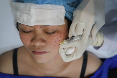 Cận cảnh mũi tiêm níu lại tuổi thanh xuân của người phụ nữ U40