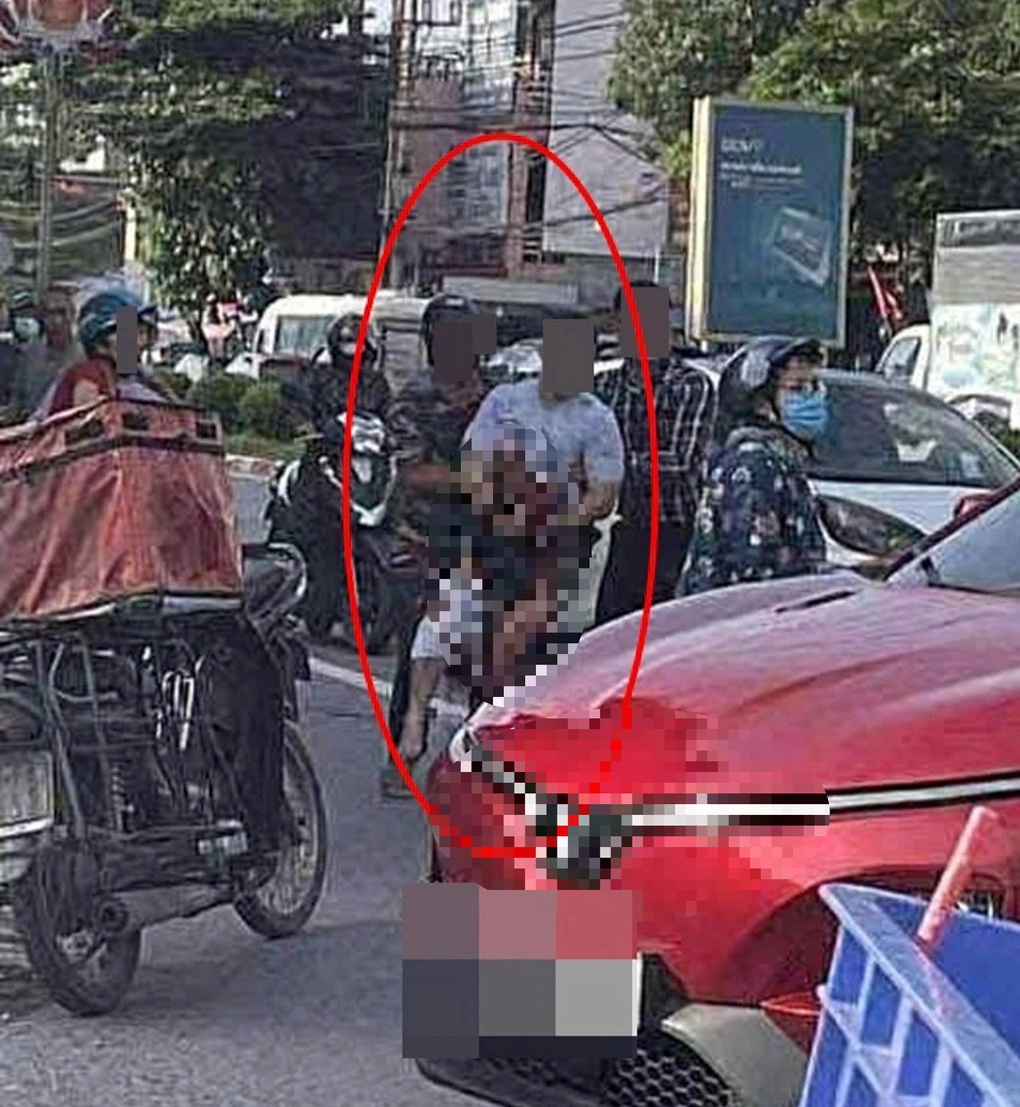 Một TikToker ở Thái Nguyên bị chém gần đứt lìa bàn tay - 1 Một TikToker ở Thái Nguyên bị chém gần đứt lìa bàn tay