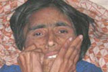 Sống sót sau 63 ngày bị vùi dưới đất