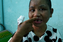 Hành trình chạy trốn khỏi "địa ngục trần gian" của cô gái bị tra tấn dã man