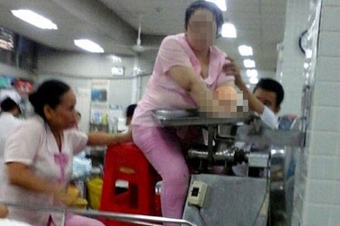 Chở cả máy xay thịt “nuốt chửng” bàn tay nạn nhân đi cấp cứu