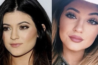 Em cô Kim phủ nhận tin đồn bơm môi