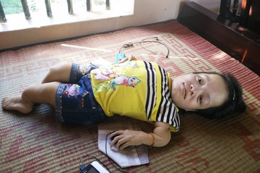 Bàn tay tài hoa của “cô gái da cam” cao 60cm