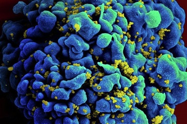 Các nhà khoa học Pháp đã tìm ra cách tiêu diệt các tế bào bị nhiễm HIV