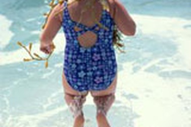 Béo phì - Dễ tử vong sớm