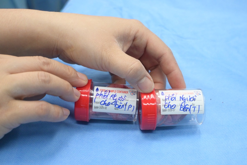 Cô gái trẻ được hồi sinh nhờ 2 lá phổi của chàng trai xa lạ - 9