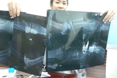 Những sai phạm “động trời” tại hai bệnh viện đầu ngành 