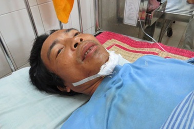 Sập giàn giáo, 3 công nhân trọng thương