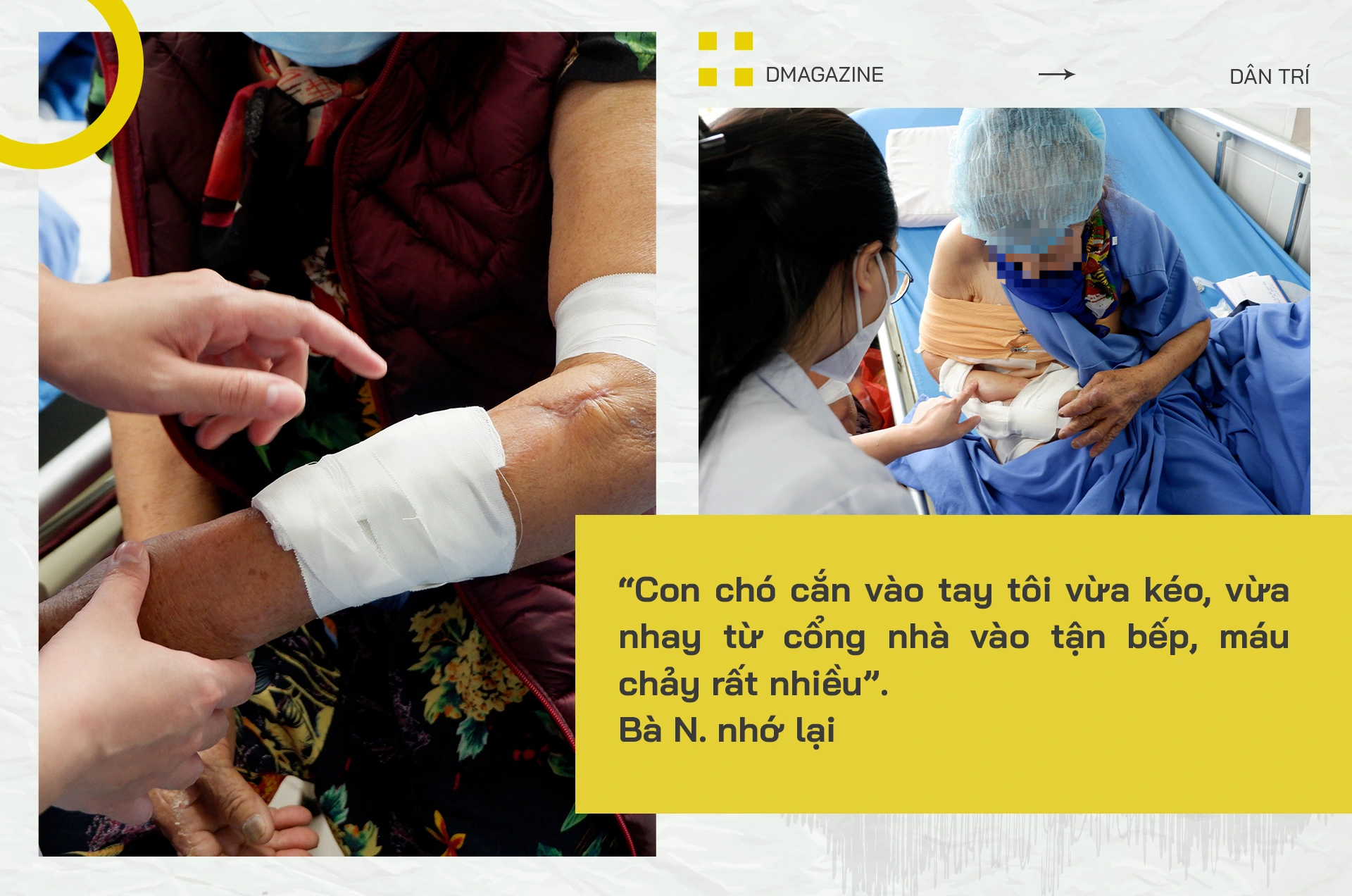 Nhát cắn đoạt mạng: Chết oan vì chó thả rông, thú cưng hóa điên phản chủ - 3 Nhát cắn đoạt mạng: Chết oan vì chó thả rông, thú cưng hóa điên phản chủ - 3