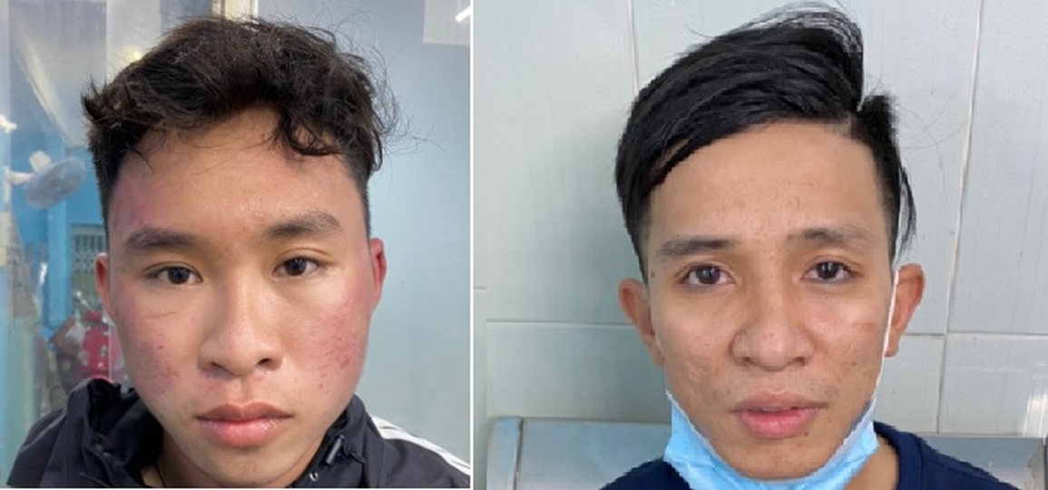 Hai tên cướp điện thoại tháo chạy 3 km vẫn bị đặc nhiệm hình sự quật ngã - 2 Hai tên cướp điện thoại tháo chạy 3 km vẫn bị đặc nhiệm hình sự quật ngã - 2