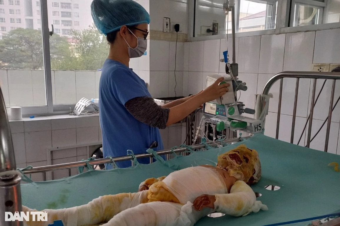 Bé 3 tuổi bị nhấn chìm trong ngọn lửa hung dữ cầu xin được cứu sống - 1 Bé 3 tuổi bị nhấn chìm trong ngọn lửa hung dữ cầu xin được cứu sống - 1