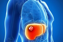 Cần làm gì khi siêu âm phát hiện khối u ở gan?