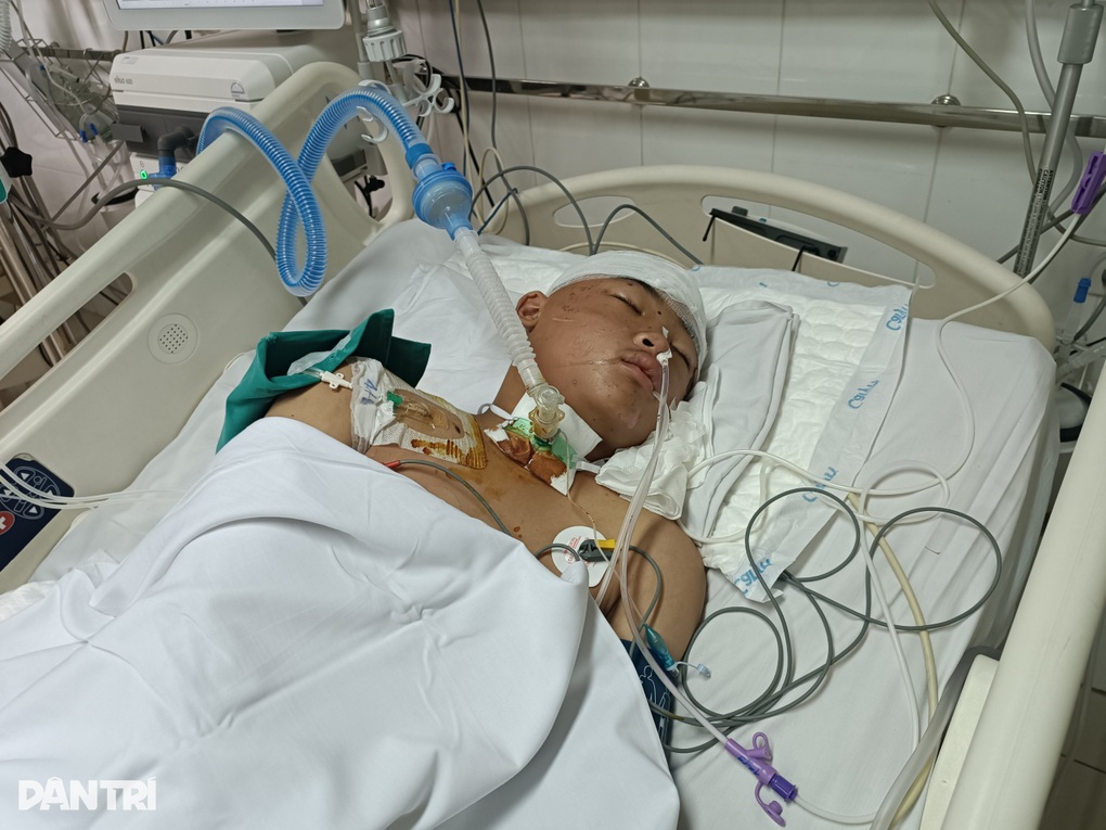 Bị xe bán tải tông trên đường đến lớp, tính mạng cậu bé lớp 8 nguy kịch - 4 Bị xe bán tải tông trên đường đến lớp, tính mạng cậu bé lớp 8 nguy kịch - 4