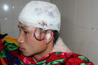 Bị gấu rừng tấn công, người đàn ông sống sót nhờ giả chết