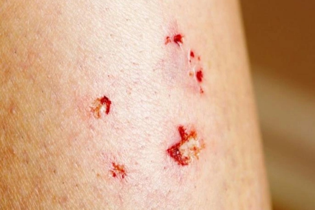 Loại virus nguy hiểm từ thú cưng có tỷ lệ tử vong lên tới 100% - 3 Loại virus nguy hiểm từ thú cưng có tỷ lệ tử vong lên tới 100% - 3