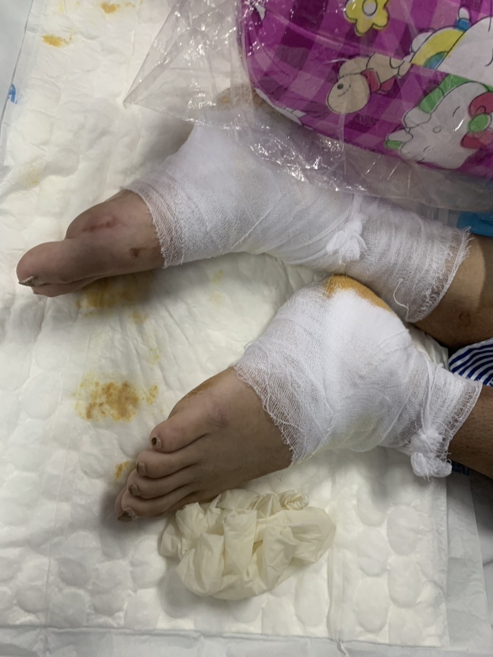 Cuộc sống cơ cực của vợ chồng người dân tộc trong viện, bệnh nhân cùng phòng sẻ từng bát cơm - 3 Cuộc sống cơ cực của vợ chồng người dân tộc trong viện, bệnh nhân cùng phòng sẻ từng bát cơm - 3