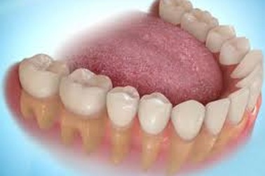 Cụ 95 tuổi suýt tử vong vì nuốt hàm răng giả vào họng