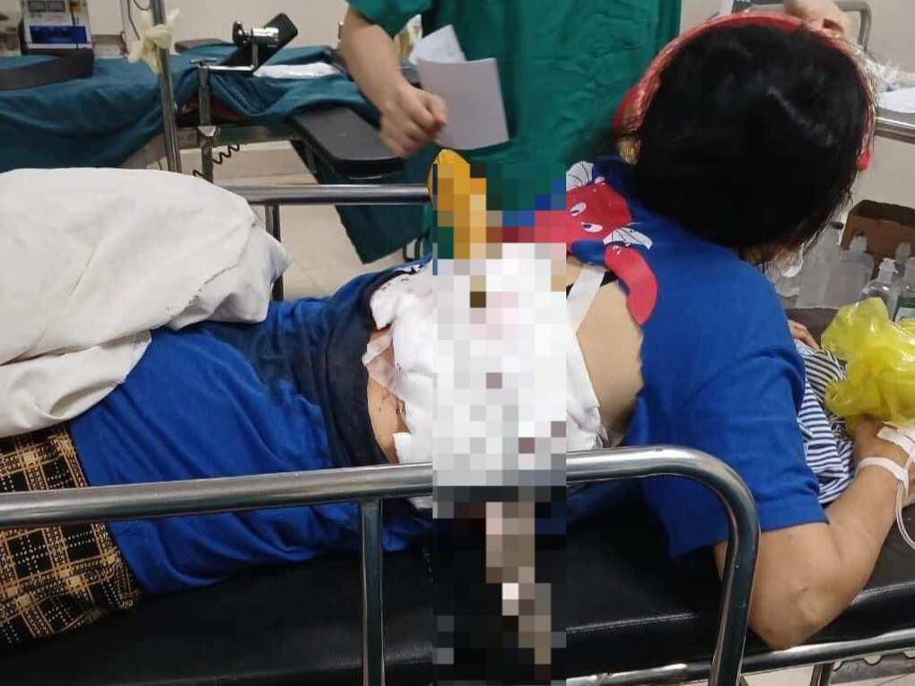 Chồng dùng dao nhọn dài 50cm phóng xuyên lưng vợ - 1 Chồng dùng dao nhọn dài 50cm phóng xuyên lưng vợ - 1