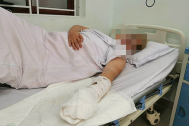 Hải Phòng: Nam thanh niên bị chém cụt 2 ngón tay tại sân bóng