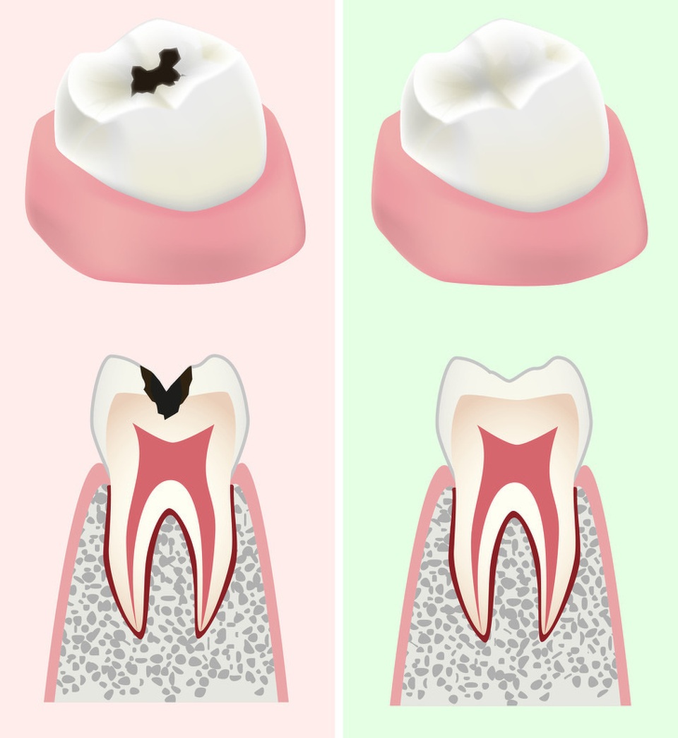 Những thay đổi của cơ thể khi bạn ăn một quả dưa chuột mỗi ngày - 6 Những thay đổi của cơ thể khi bạn ăn một quả dưa chuột mỗi ngày - 6