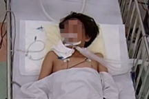 Nằm ngủ dưới nền nhà, bé trai 13 tuổi bị rắn độc dài 1 mét cắn nguy kịch