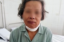 Tưởng viêm họng, sâu răng, người phụ nữ chết lặng vì mắc căn bệnh nguy hiểm