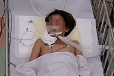 Nằm ngủ dưới nền nhà, bé trai 13 tuổi bị rắn độc dài 1 mét cắn nguy kịch