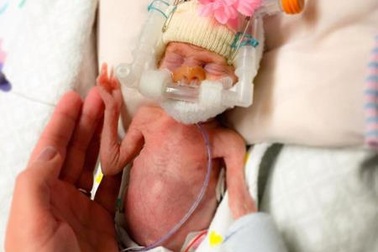 Phép lạ dành cho cặp sinh non nhỏ như búp bê