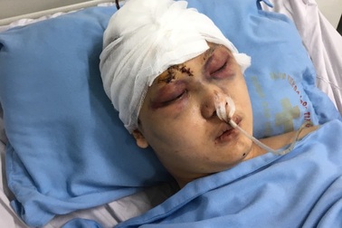 Bỏ học chăm mẹ bệnh, bố thần kinh, cậu sinh viên gặp nạn vô cùng nguy kịch