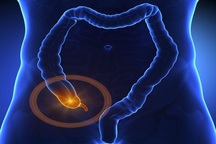 Dấu hiệu ung thư ruột thừa