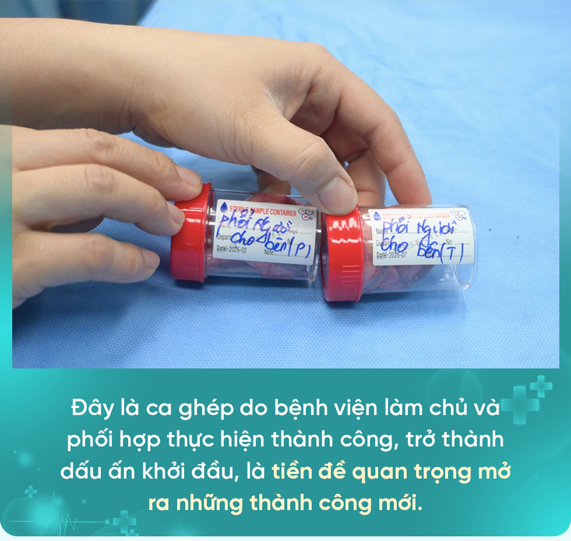 Những cuộc đời được hồi sinh và giấc mơ về trung tâm ghép phổi vùng - 3 Những cuộc đời được hồi sinh và giấc mơ về trung tâm ghép phổi vùng - 3