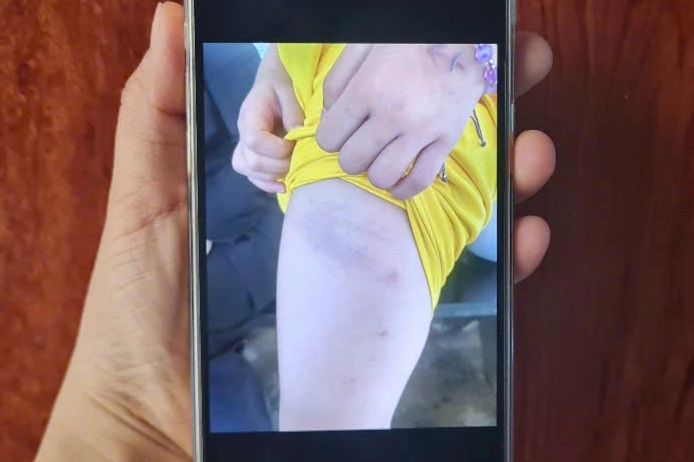 תלמיד מכה במקרה עם חוט חשמלי: החלפת מחנכת כיתה, שקלו להעניש את המורה - 1 Vụ đánh học sinh bằng dây điện: Đổi chủ nhiệm, xem xét xử lý cô giáo - 1