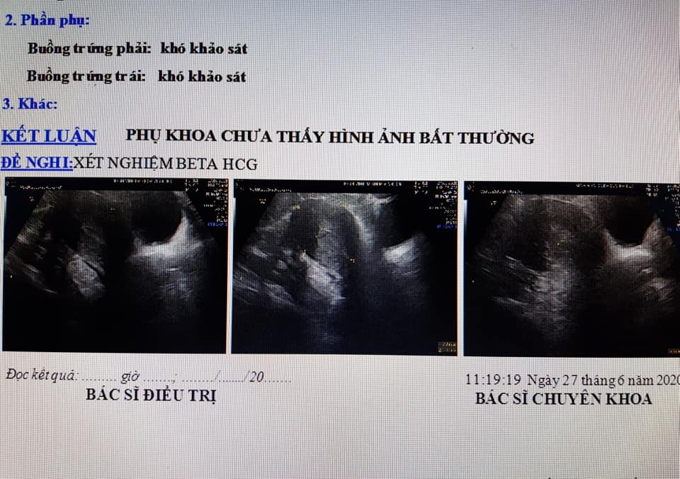 Quảng Nam: Vác bụng bầu đi đẻ, đến viện bác sĩ phát hiện không có thai - 1 Quảng Nam: Vác bụng bầu đi đẻ, đến viện bác sĩ phát hiện không có thai - 1