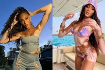 Siêu mẫu bạch biến Winnie Harlow từng bị bạn bè xa lánh