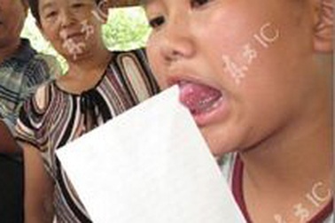 Cậu bé sở hữu “lưỡi rắn” kỳ lạ