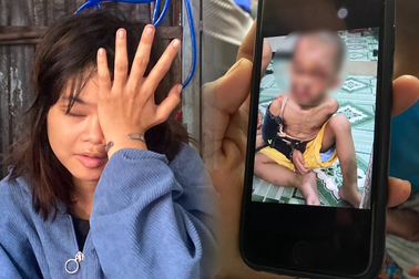 Cuộc giải cứu bé trai 2 tuổi nghi bị bố mẹ đổ nước sôi, châm thuốc ở TPHCM